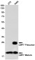 PSMB8 Rabbit mAb ABZ2601