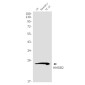 HMGB2 Rabbit mAb ABZ2616