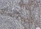 Hsp70 Rabbit mAb ABZ2642