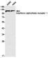 Interferon alpha/beta Receptor 1 Rabbit mAb ABZ2653