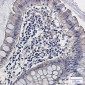 ALDH2 Rabbit mAb ABZ2666