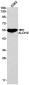ALDH2 Rabbit mAb ABZ2666