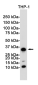 CD8 alpha Rabbit mAb ABZ2695