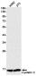Cystatin C Rabbit mAb ABZ2702