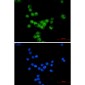 Cyclin E2 Rabbit mAb ABZ2721
