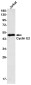 Cyclin E2 Rabbit mAb ABZ2721