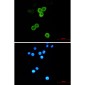 Anterior Gradient 2 Rabbit mAb ABZ2724