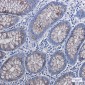 Anterior Gradient 2 Rabbit mAb ABZ2724