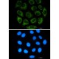 Glutaminase Rabbit mAb ABZ2733
