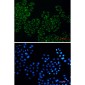 Citrate Synthetase Rabbit mAb ABZ2743