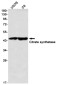 Citrate Synthetase Rabbit mAb ABZ2743