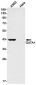 GATA1 Rabbit mAb ABZ2763