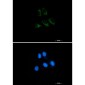 Thrombomodulin Rabbit mAb ABZ2767