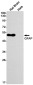 GFAP Rabbit mAb ABZ2794