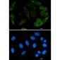 Profilin 1 Rabbit mAb ABZ2796