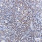 Profilin 1 Rabbit mAb ABZ2796
