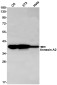 Annexin 2 Rabbit mAb ABZ2833