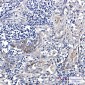 ERAP1 Rabbit mAb ABZ2841