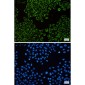 ATPB Rabbit mAb ABZ2846