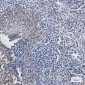 ATPB Rabbit mAb ABZ2846