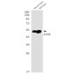 ATPB Rabbit mAb ABZ2846