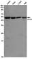 ATPB Rabbit mAb ABZ2846