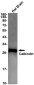 Calbindin Rabbit mAb ABZ2862