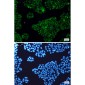 Calretinin Rabbit mAb ABZ2863