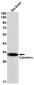 Calretinin Rabbit mAb ABZ2863