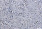 Galectin 1 Rabbit mAb ABZ2963