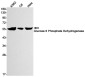 Glucose 6 Phosphate Dehydrogenase Rabbit mAb ABZ2970