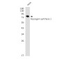 Glycogen synthase 1/GYS1 Rabbit mAb ABZ2973
