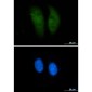 GST3 / GST pi Rabbit mAb ABZ2979