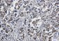 GST3 / GST pi Rabbit mAb ABZ2979