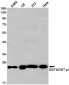 GST3 / GST pi Rabbit mAb ABZ2979