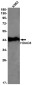 HDAC8 Rabbit mAb ABZ2984