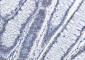 Histone H2A.X Rabbit mAb ABZ2988