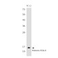 Histone H2A.X Rabbit mAb ABZ2988