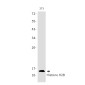 Histone H2B Rabbit mAb ABZ2990