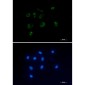 IL-1RA Protein Rabbit mAb ABZ3013