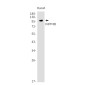 INPP4B Rabbit mAb ABZ3018