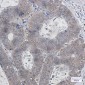 Ubiquitin K48 Rabbit mAb ABZ3025