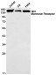Mannose Receptor/CD206 Rabbit mAb ABZ3044