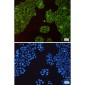 c-Met Rabbit mAb ABZ3048