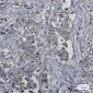 c-Met Rabbit mAb ABZ3048