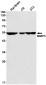 MMP3 Rabbit mAb ABZ3056