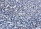 PARP1 Rabbit mAb ABZ3107