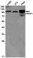 PARP1 Rabbit mAb ABZ3107