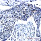 PRC1 Rabbit mAb ABZ3127