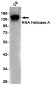 RNA Helicase A Rabbit mAb ABZ3149